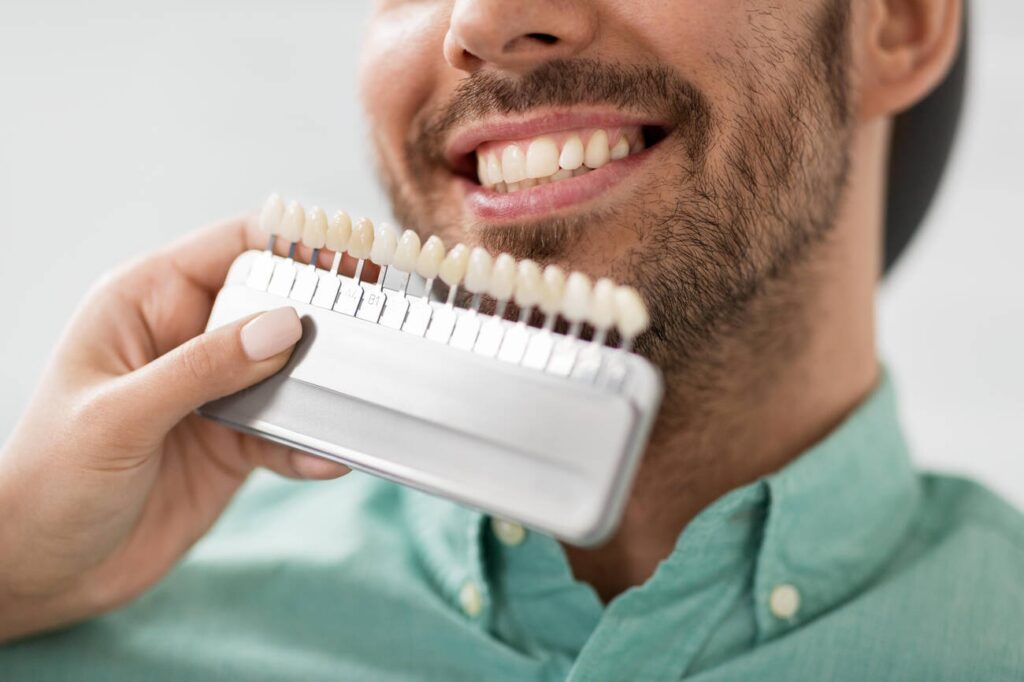 Are Veneers Permanent?