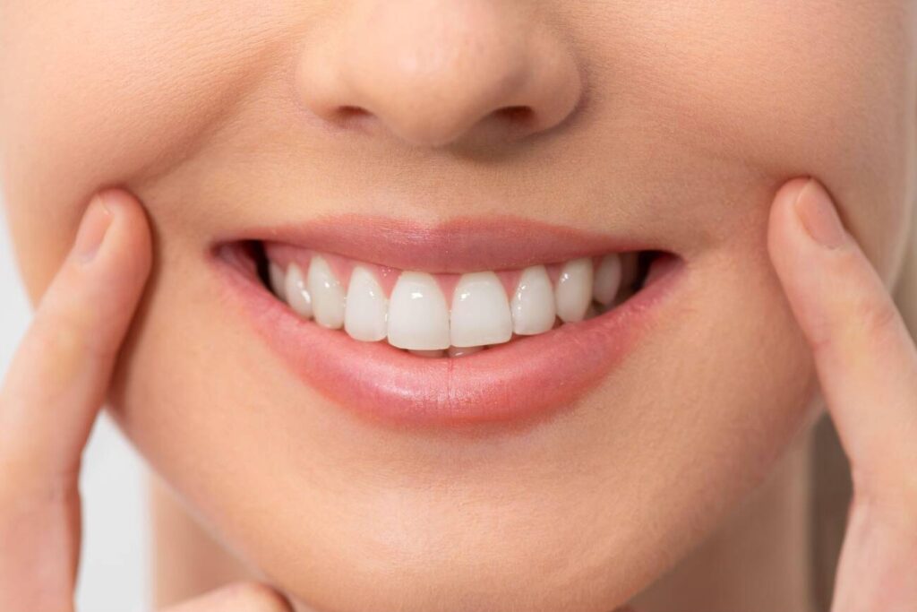 What is Composite Bonding?