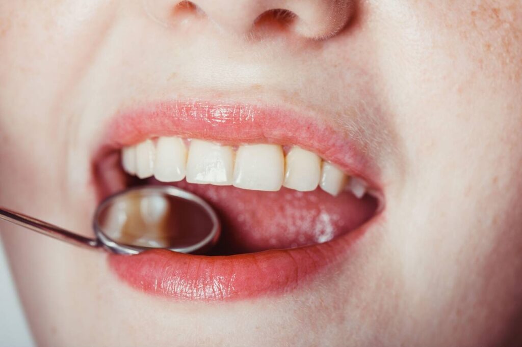 Are Cavities Contagious?