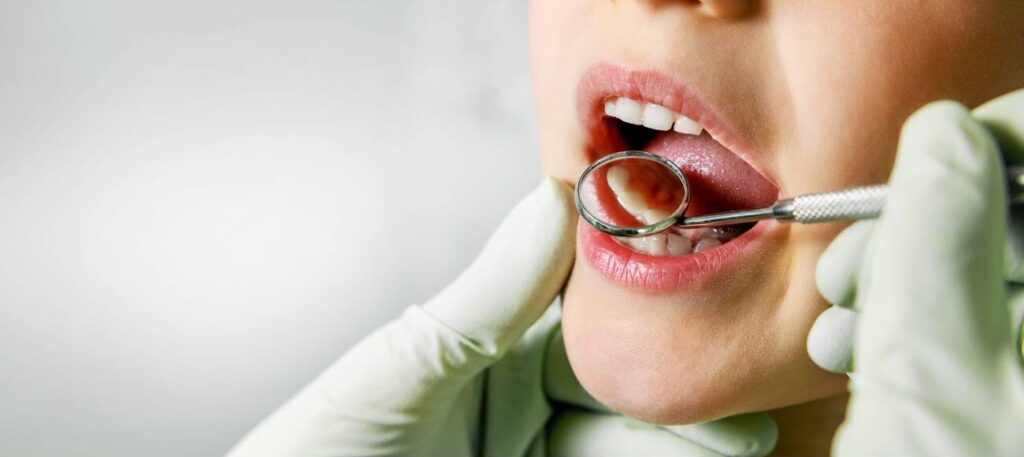 Are the materials used for Composite Bonding harmful?