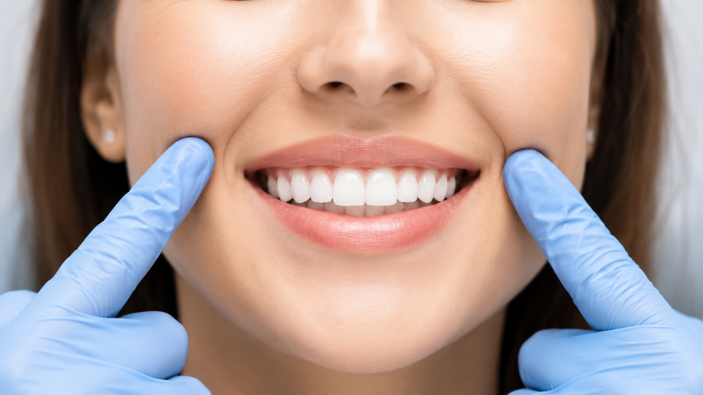 Composite Bonding After 5 Years – What London Patients Need to Know