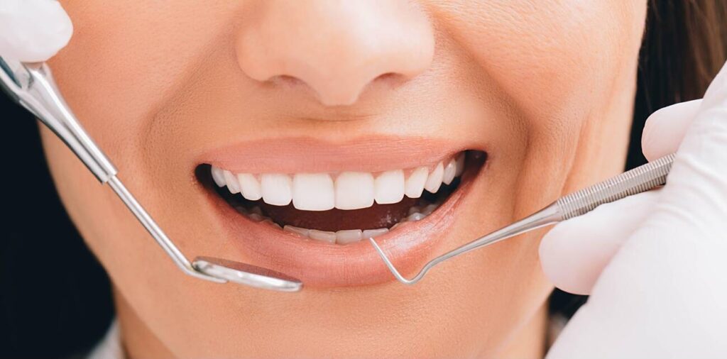 Pros And Cons Of Composite Bonding