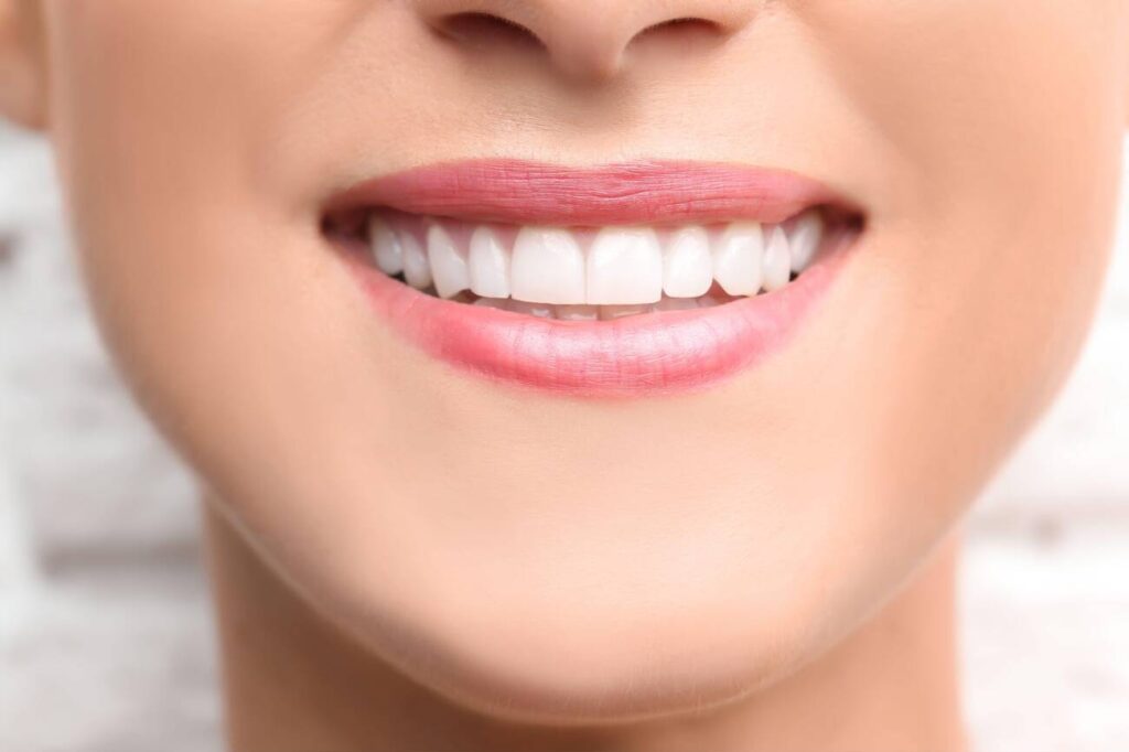 How Much is Composite Bonding for 2 Teeth?