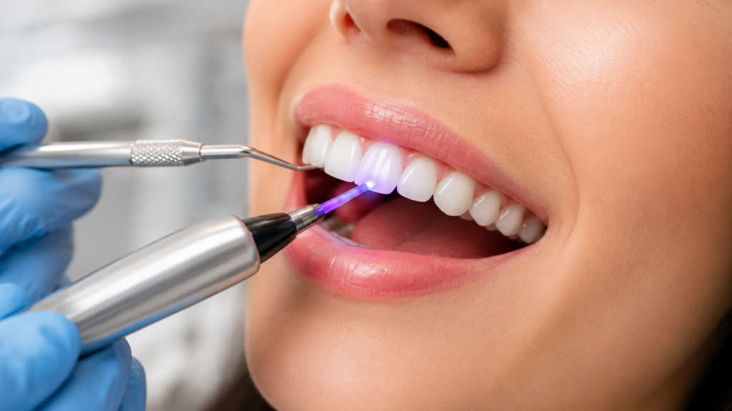 Can I Get Composite Bonding on just 2 Teeth?