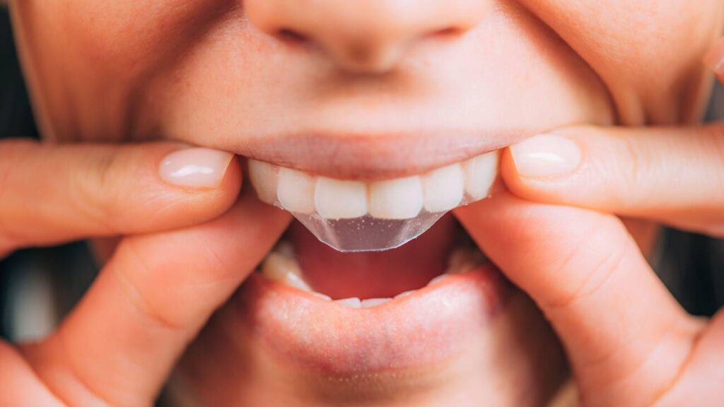 Are whitening strips bad for your teeth?