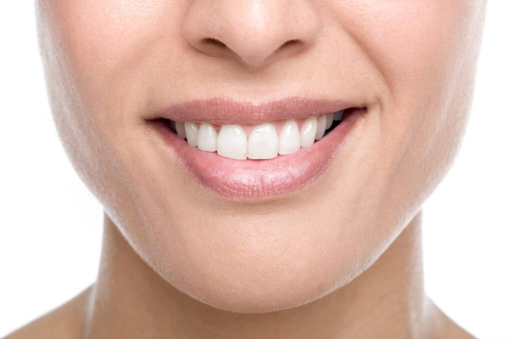 Can a Bonded Tooth Be Whitened? Here’s the Honest Truth