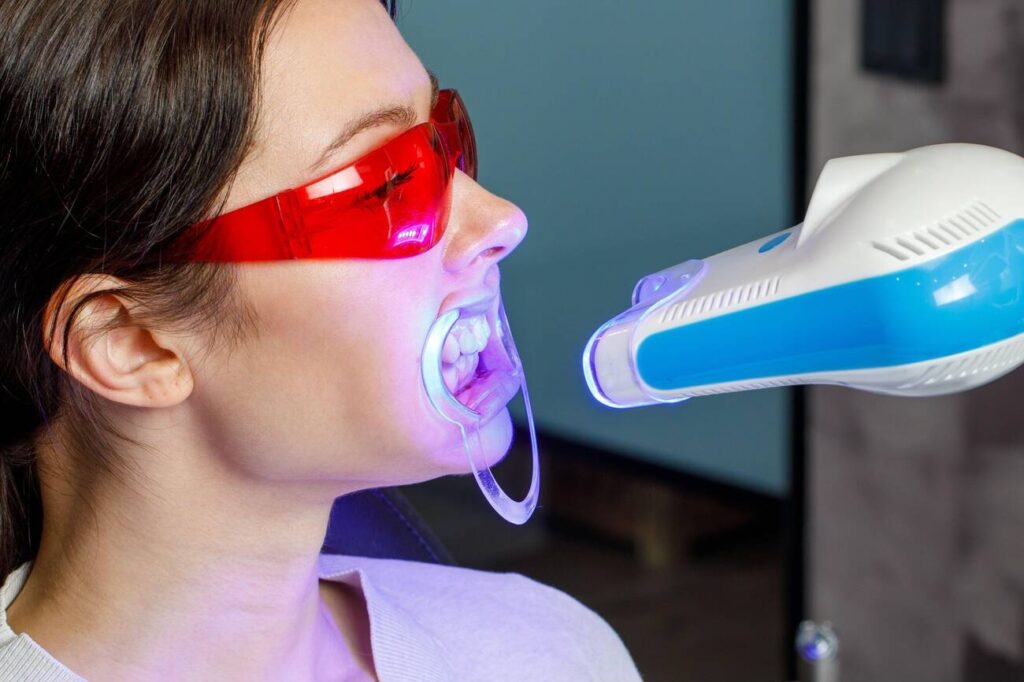 Does uv light whiten teeth?