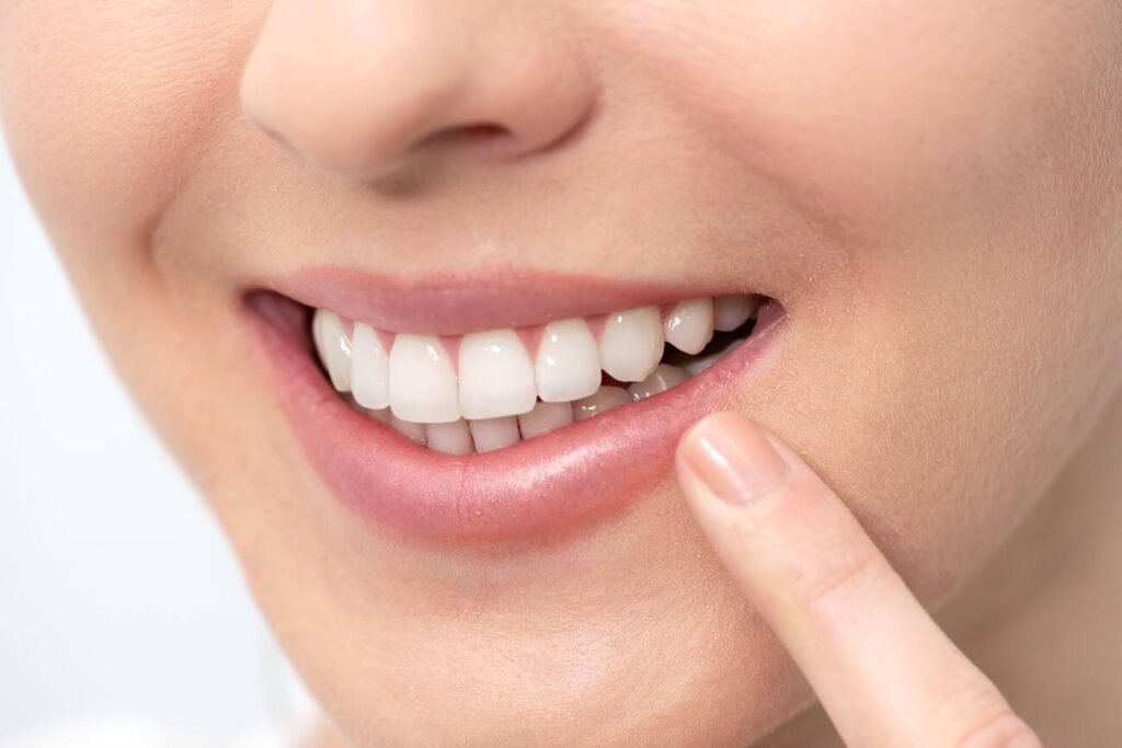 How to Whiten Resin Teeth
