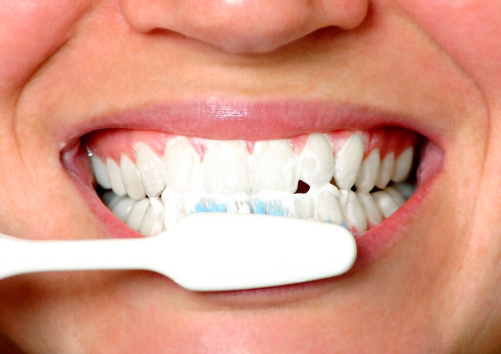 Should i brush my teeth after using whitening strips?