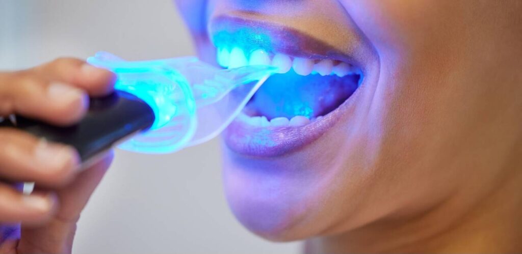 What is the use of LED curing light in dentistry