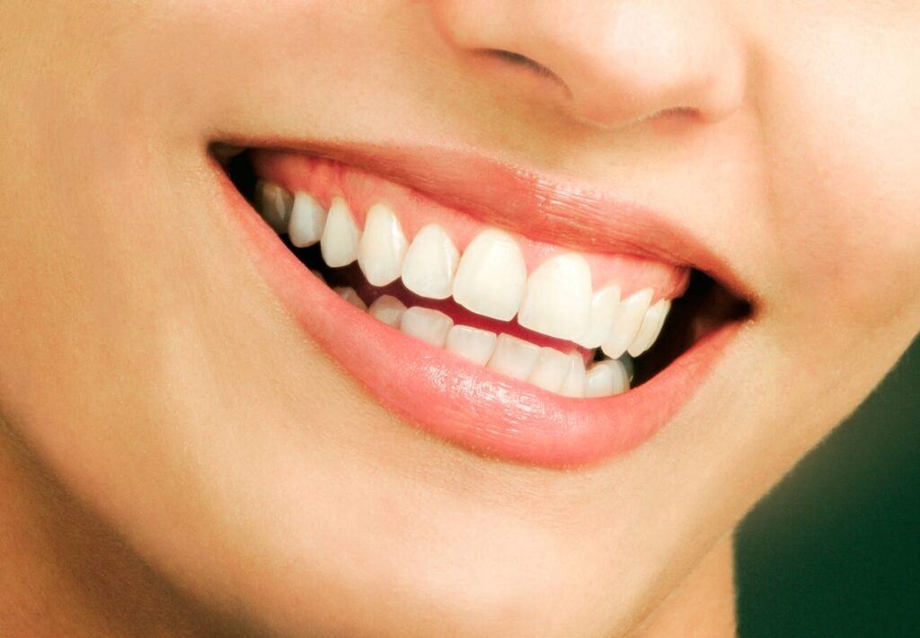 What is the whitest shade of teeth?