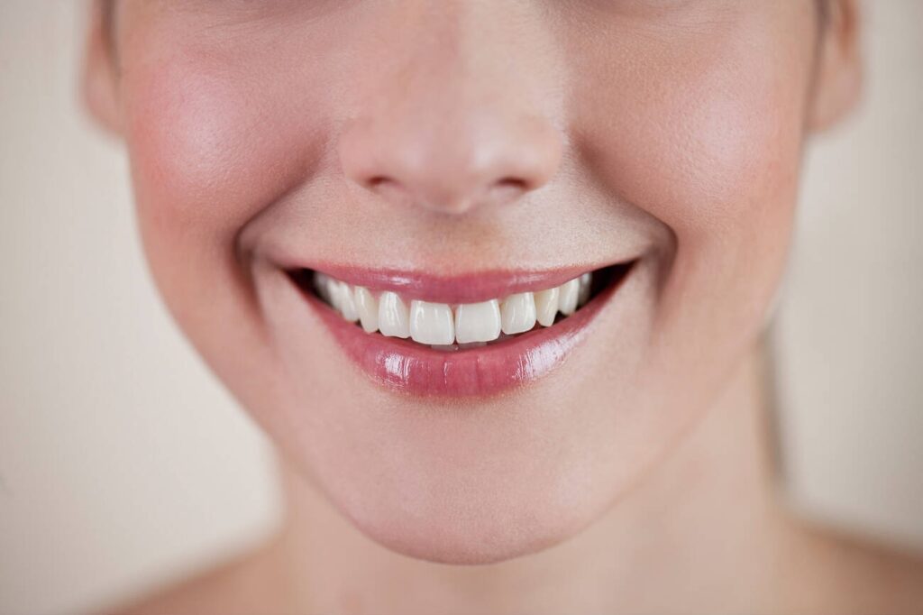 Why Isn’t the Bond Sticking on My Chipped Front Tooth Filling